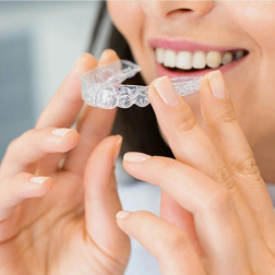 Top Benefits of Invisalign Treatment in Raleigh