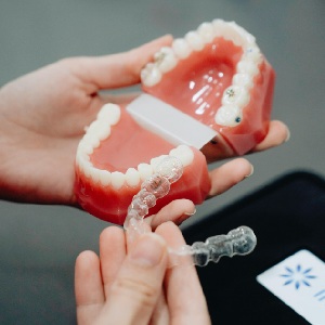 Top Mistakes to Avoid During Invisalign Treatment in Raleigh